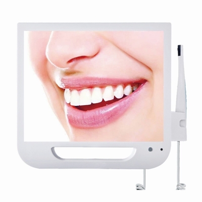 17 inch LED-scherm tandheelkundige endoscoop fabriek hoge pixel intra orale camera met wifi