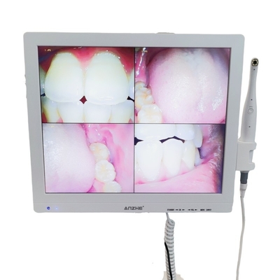 Wifi All In One orale camera met luidspreker LCD-scherm tandheelkundige orale camera scanner