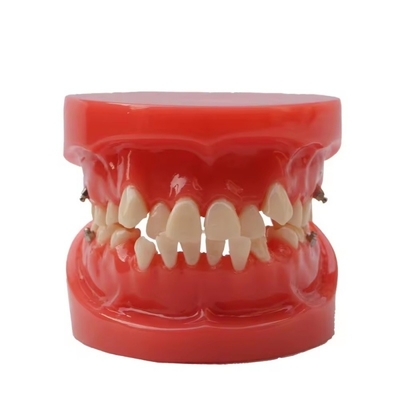 Opleiding Gebruik tandheelkundige tanden Onderwijsmodel Functioneel tandheelkundig orthodontisch model zonder beugel