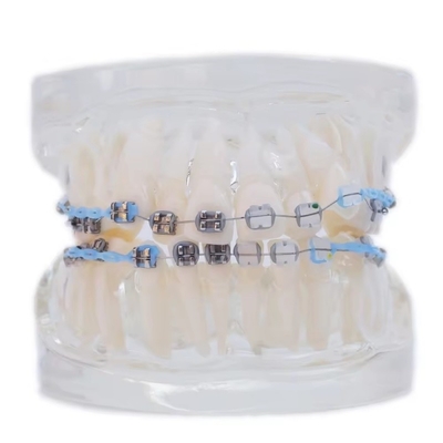 Multicolor menselijke tanden model voor onderzoek tandheelkundige orthodontische tanden model met beugel