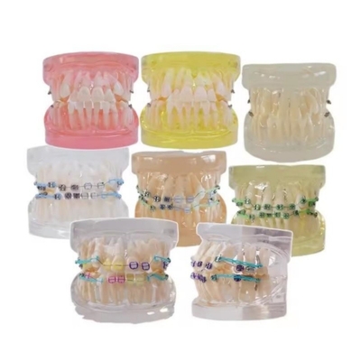Multicolor menselijke tanden model voor onderzoek tandheelkundige orthodontische tanden model met beugel