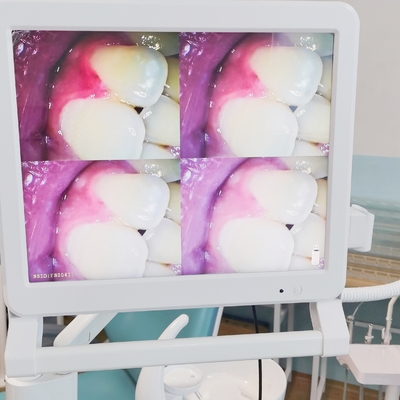 Tandheelkundige endoscoop met 17 inch monitor wifi draagbare tandheelkundige camera intraorale endoscoop intraorale camera
